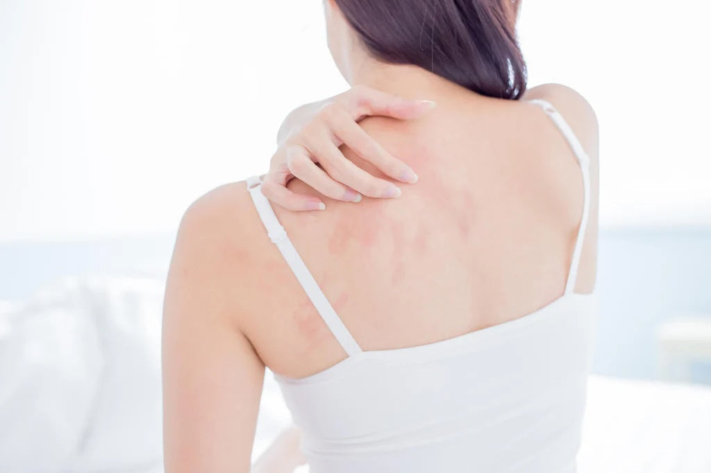 Allergy-friendly lingerie and sensitive skin: a deep dive into materials and allergens